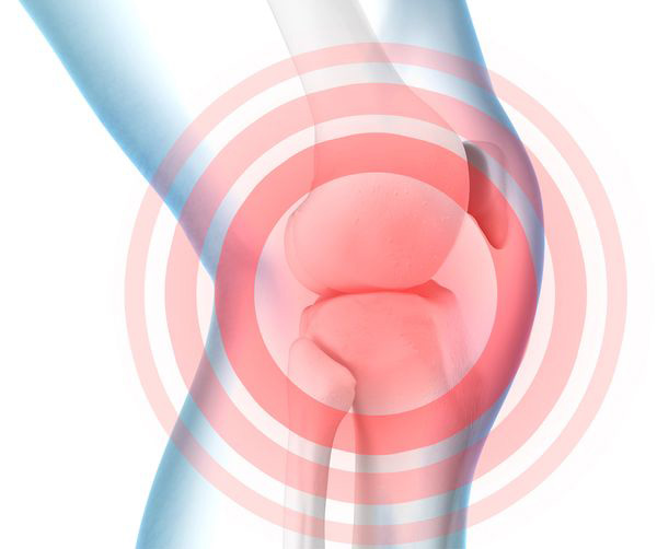 Illustration of knee pain with red target circles highlighting the knee joint.