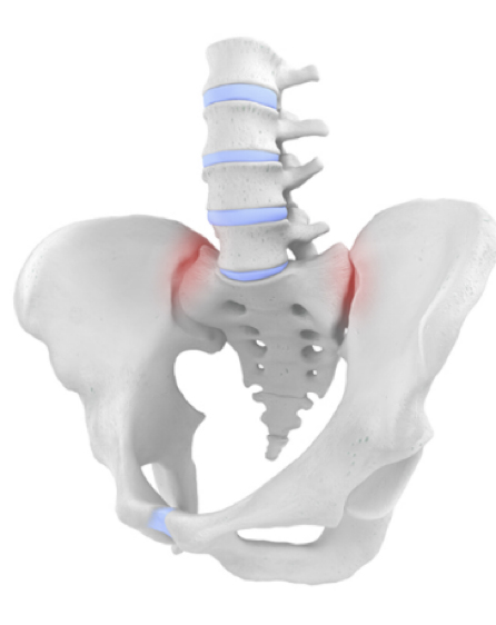 Anatomical illustration of human pelvis and lower spine with highlighted red areas indicating pain or inflammation.