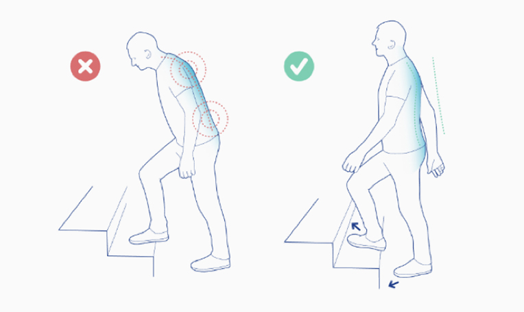 Correct and incorrect posture while walking up stairs illustration.